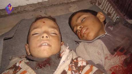 أحد الأطفال الضحايا نتيجة لاستهداف سوق مدينة عربين